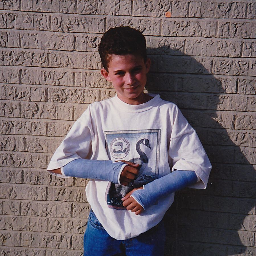 Justin Willman broke both arms